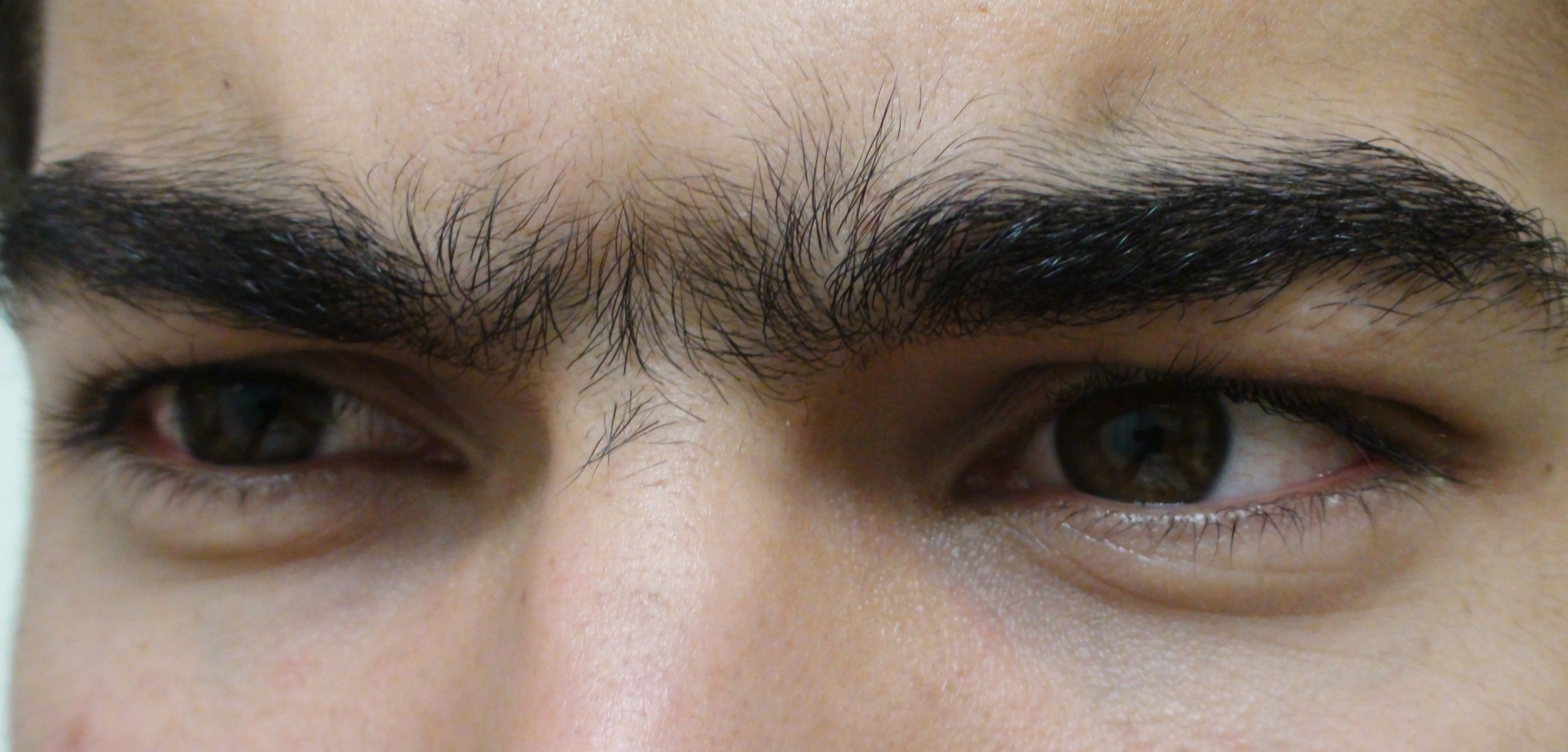 Unibrow_Close_Up